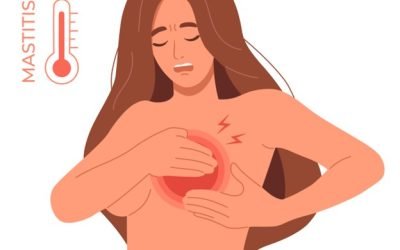 Mastitis and Clogged Milk Ducts: Navigating Common Breastfeeding Challenges