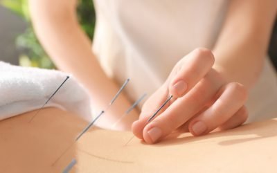 Enhancing Breastfeeding Journey: The Role of Acupuncture in Supporting Lactation